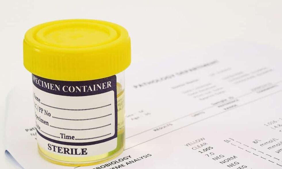 Πρέπει να γίνει εξέταση ούρων πριν από τη λήψη αντιβιοτικών